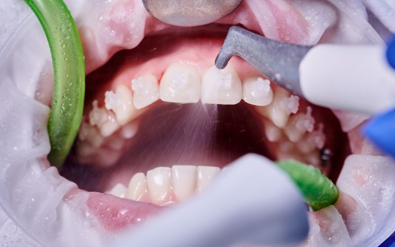 lekarz periodontolog